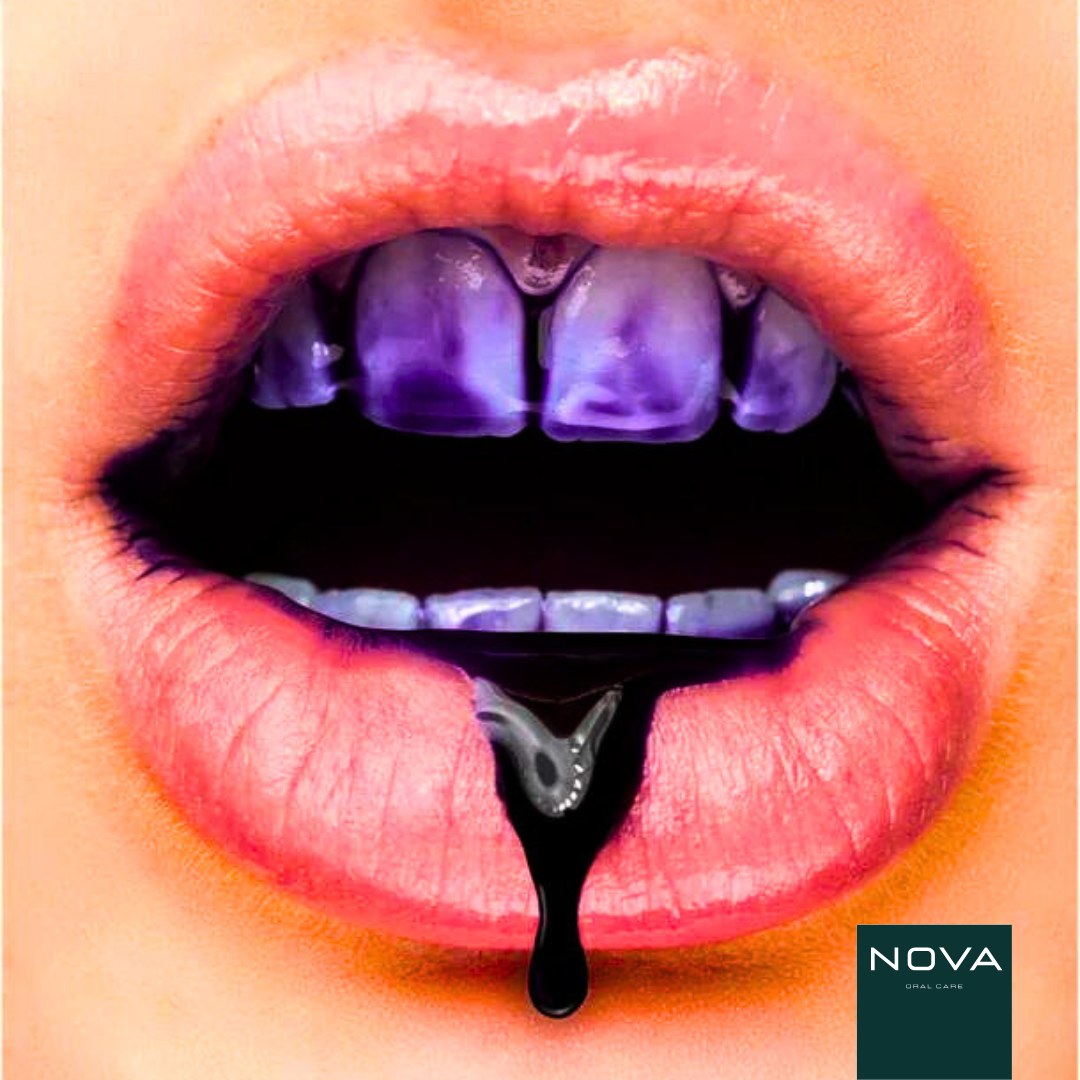v34+ Fast Whitening Bundle - Nova® Oral Care | At-Home Teeth Whitening
